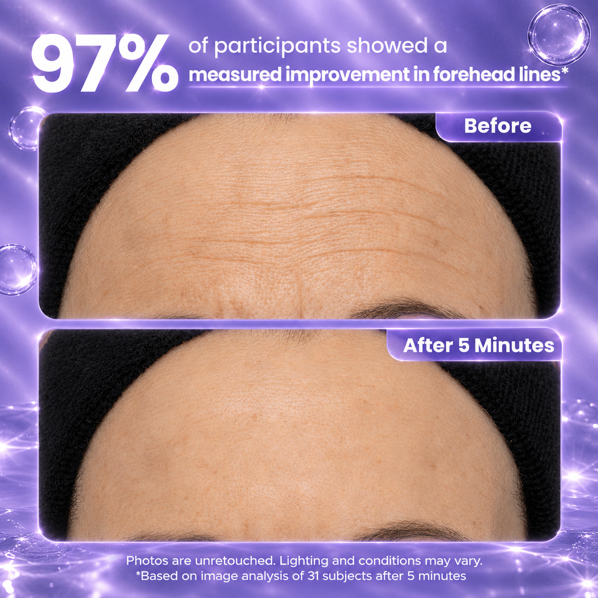 Instant Eye lift Gel