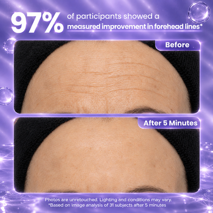 Instant Eye lift Gel