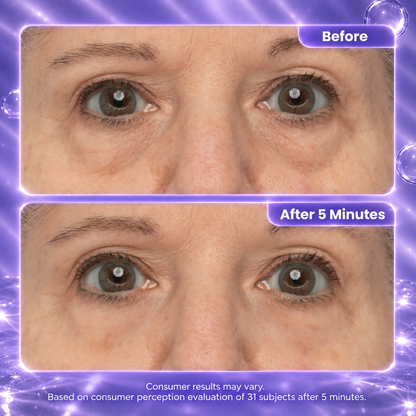 Instant Eye lift Gel